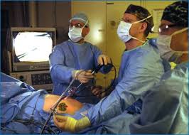 Laparoscopic (Keyhole) Surgeries
